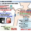 貼るワクチン