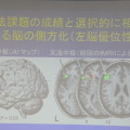 酒井氏の研究結果。言語を習得が得意な人は、文法中枢が非対称で、体積も大きく優位になることを突きとめた