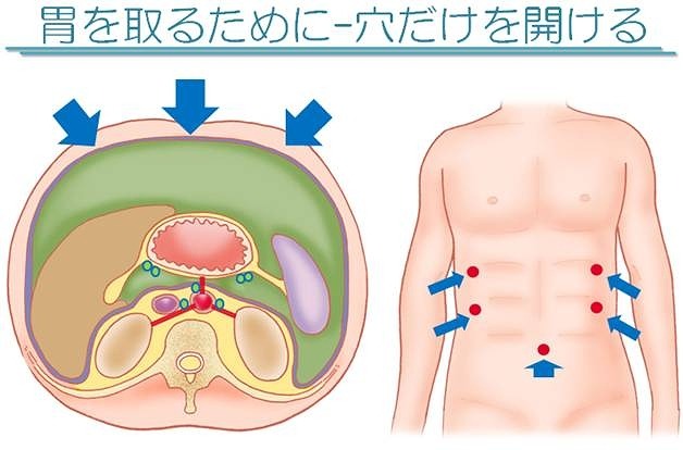 スライド例