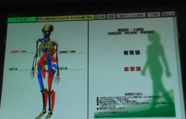 骨格のゆがみを3Dで表示