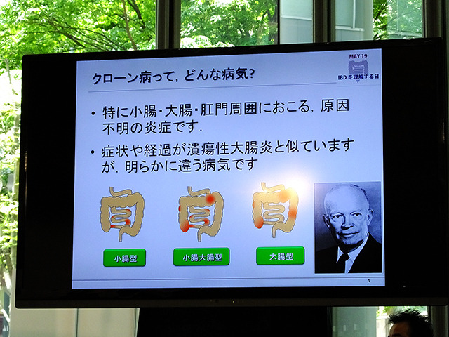 IBDを理解する日 2014疾患啓発イベント