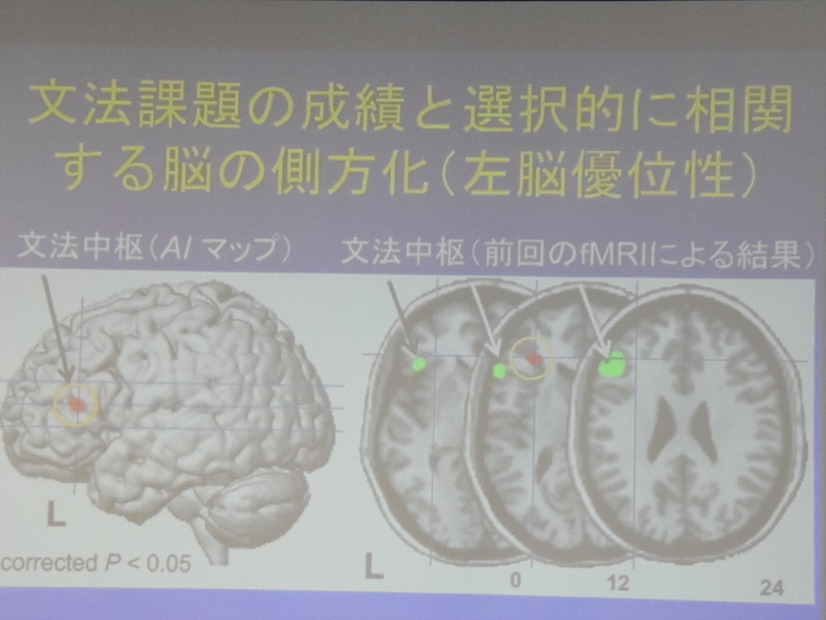 酒井氏の研究結果。言語を習得が得意な人は、文法中枢が非対称で、体積も大きく優位になることを突きとめた