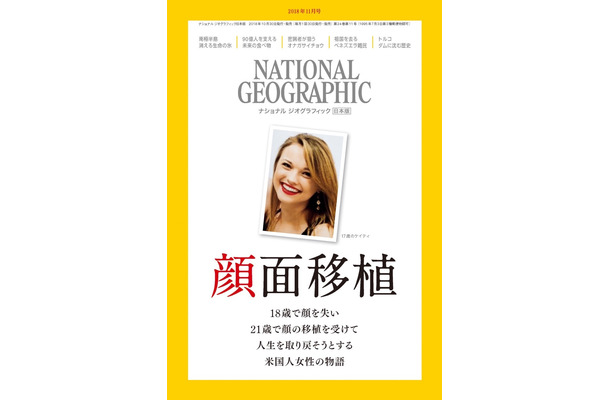 米国人女性の顔面移植を特集ーー10月30日発売『ナショナル ジオグラフィック日本版2018年11月号』