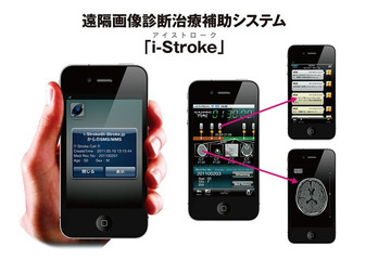 富士フイルム、スマートフォンで脳卒中患者の救急医療をサポート 画像